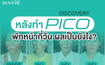 รีวิว 7 วัน หลังทำ Discovery PICO หลุมสิว พักหน้ากี่วัน?