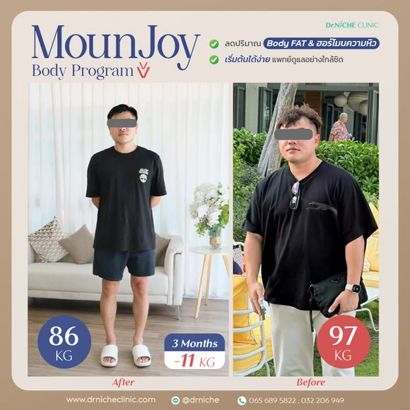 รีวิวการลดน้ำหนักที่ Dr.Niche Clinic บ้านโป่ง ราชบุรี