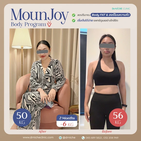 รีวิวการลดน้ำหนักที่ Dr.Niche Clinic บ้านโป่ง ราชบุรี