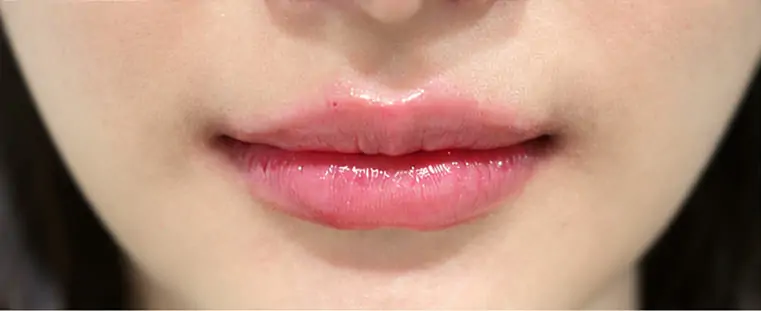 After · เน้นเสริมลุคคุณหนู