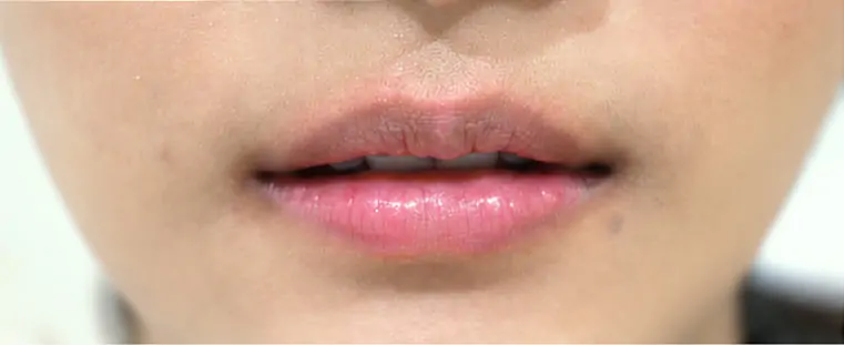 Before · เน้นเสริมลุคคุณหนู