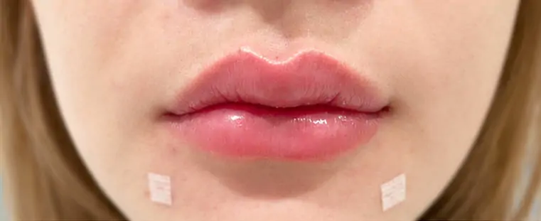 After · ปรับทรงให้ชัด