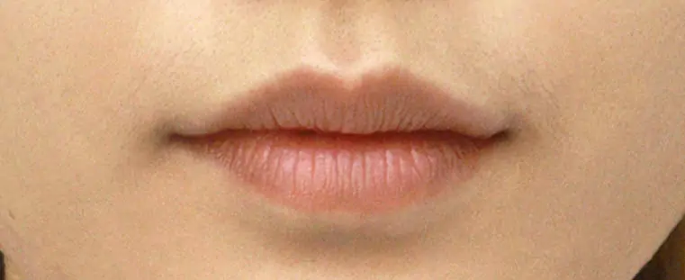 Before · ทรงธรรมชาติ