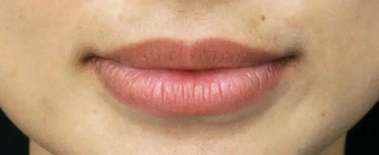 Before · เน้นความอิ่มฟู