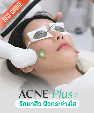 บริการรักษาสิว Acne Plus